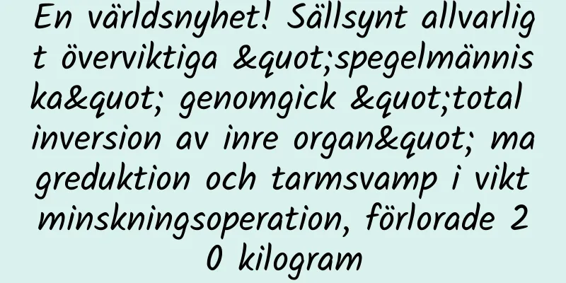 En världsnyhet! Sällsynt allvarligt överviktiga "spegelmänniska" genomgick "total inversion av inre organ" magreduktion och tarmsvamp i viktminskningsoperation, förlorade 20 kilogram