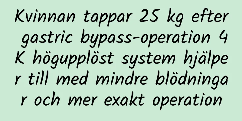 Kvinnan tappar 25 kg efter gastric bypass-operation 4K högupplöst system hjälper till med mindre blödningar och mer exakt operation