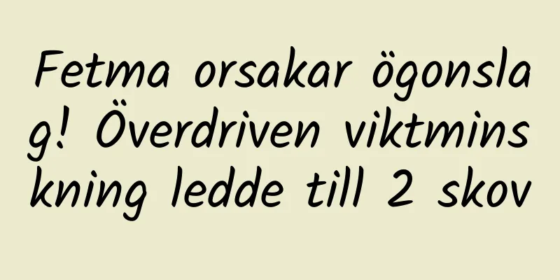 Fetma orsakar ögonslag! Överdriven viktminskning ledde till 2 skov
